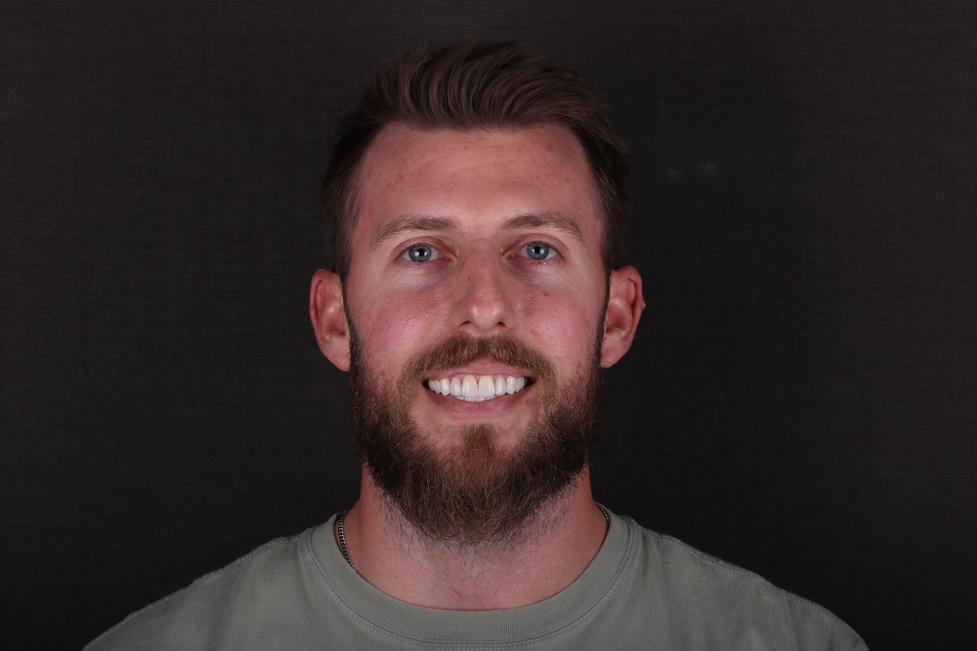 Element Z Crown_Lisi Press Select Veneer-Case2999984-2