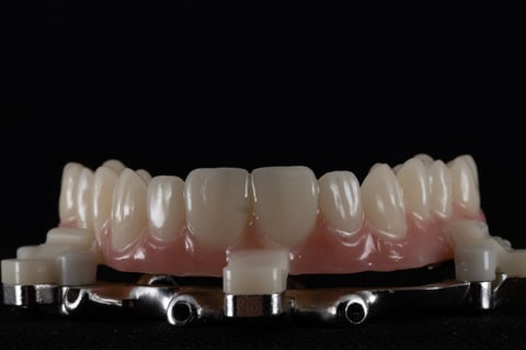 Maxillary Full Arch Implant on Oral Arts Dental Labs Guide
