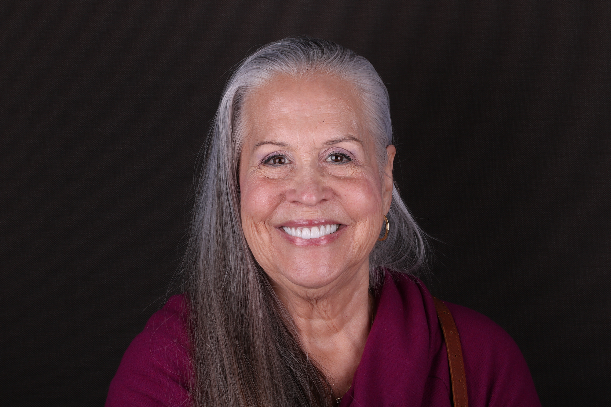 LiSi Press Select Veneer Crown Bridge-Case3174355-2