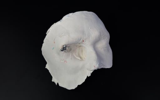 Orbital Implant Oral Arts Dental Labs 