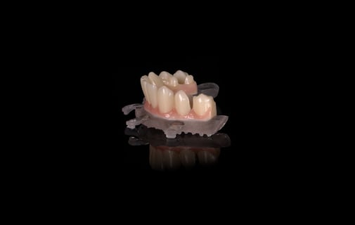 Implant Crown Prosthodontics Oral Arts Dental Labs 